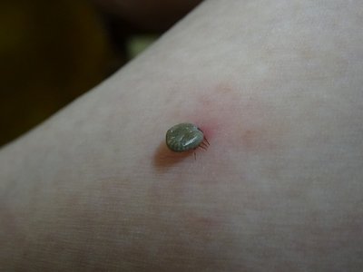 くらいついているダニ