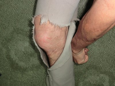 CIMG0450.JPG (236.88 KiB) 閲覧された回数 3645 回 代償。あーあ、白魚の様なお肌が・・・